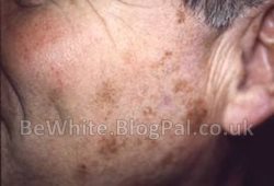 Facial whitening cream for Malawi woman