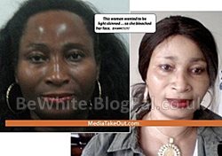 Bleaching neck cream for Black Jamaican people