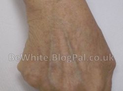 Whitening skin creams for Bangladeshi people