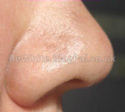 Whitening cream best for Malawi woman