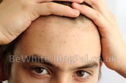 Natural skin whitening cream for Filipino