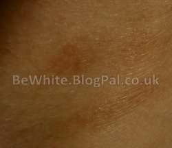 Skin lighteners for Somali