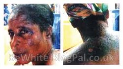 Top skin whitening cream for Thai woman