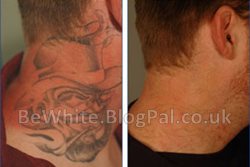 Body whiten for Zambian women