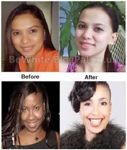 Lightening cream for Malawian women