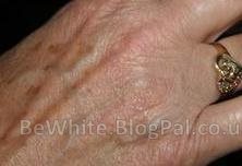 Best whitening face cream for Zimbabwean people