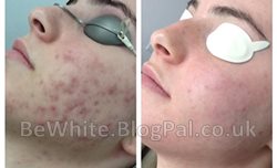 Whiten face for Malawi