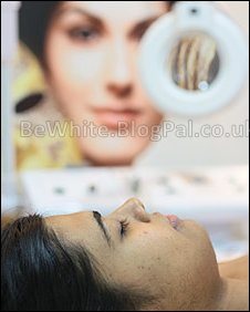 Skin bleaching for dark skin
