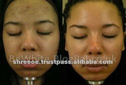 Body skin whitening for Indian woman