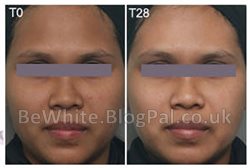 Whitening face creams for Africans