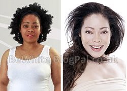 Kojic acid products for Somalian