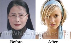Skin treatments for Nigerian women