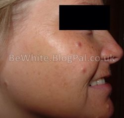 Whitening body for Jamaican