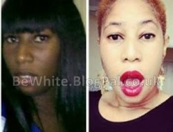 Bleach your skin for Asian women