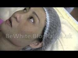 Natural skin whitening tips for Thai men