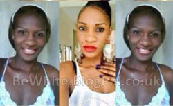 Best skin lightener for Zambian woman