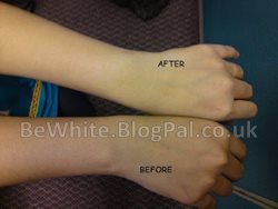 Best skin bleaching cream for Filipino women
