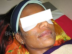 Bleaching arm cream for Somali people