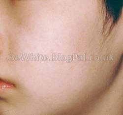 Skin lightening product for South African women