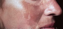 Lighten skin tone for Black Trinidadians men