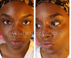 Best whitening products for Zambia people