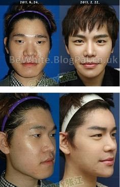 Whitening neck cream for Ugandan men