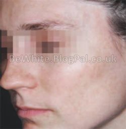Natural whitening skin for Ghanaian women