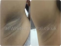 Asian skin whitening for Ghanaian people