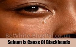 Natural skin whitening tips for Uganda men