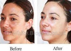 Bleaching face cream for Zimbabwean men