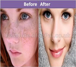 Skin lighteners for Zambia people