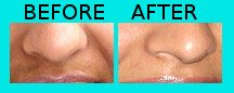 Natural skin whitening cream for Asian people