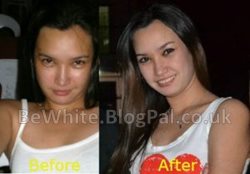 Skin lightening facial for Zambia woman