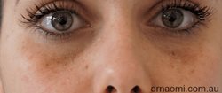 Whitening neck cream for Congo woman