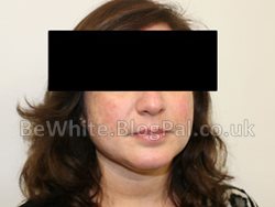 Whitening neck creams for Trinidadians