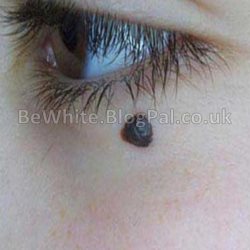 Effective skin whitening for Africans people