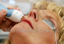 Skin brightening for Asian