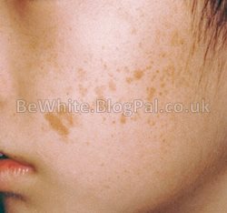 Lightening face creams for Zambia men