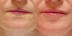 Natural skin whitening for Somali woman