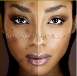 Most effective whitening cream for Malawi