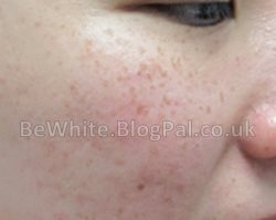 Whitening creams for face