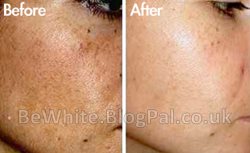 Body whitening lotion for Zambia woman