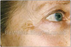 Natural skin bleaching for Zambia people