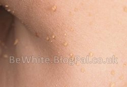 Skin care product for Malawi woman