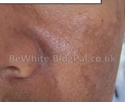 Best skin whitening cream for Ghana women