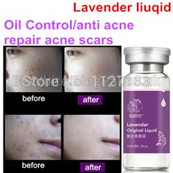 Facial whitening cream for Filipino people