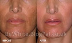 Skin whitening body cream for Congolese people