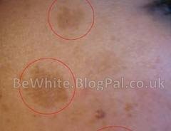 Lightening body creams for Pakistani