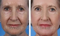 Best face whitening cream for Ugandan