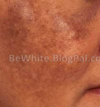 Ageing creams for Uganda men